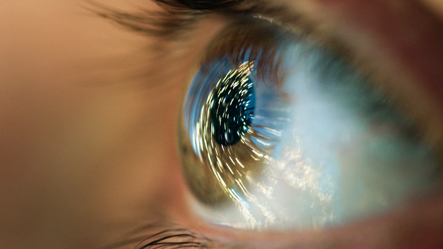 What Exactly Is Astigmatism?